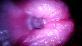 Endoscope camera captures moment of male ejaculation