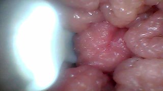 Endoscope Camera Shows the Most Sensitive Parts of the Penis Educational Video