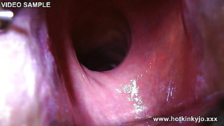 Deep View and Deep Play. Xo Speculum Huge Gape by Hotkinkyjo