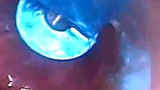 Endoscope POV: Test Tube Cock Urethral Insertion