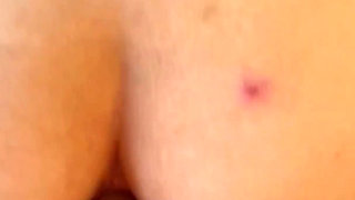 Total Anal in the Young Brazilian