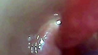 Endoscope POV: Test Tube Cock Urethral Insertion