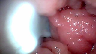 First Time: an Endoscope Reveals the G-spot up Close - Without Mounting!