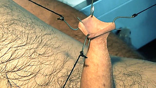An Artful Study in Needles and Steel