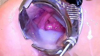 Latex Bunny Extreme Gape and Fart Session