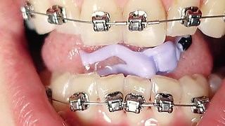 Giantess Devour Fetish in Braces