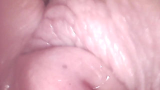 Cervix Ovulation Play With Endoscope And Voiceover