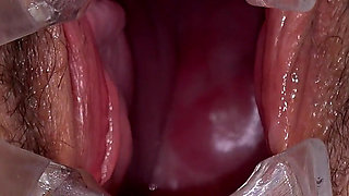 Hairy Mature Pussy Examined by Two Doctors