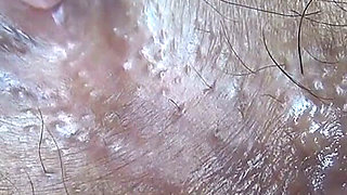Extreme Close-up of an Anus